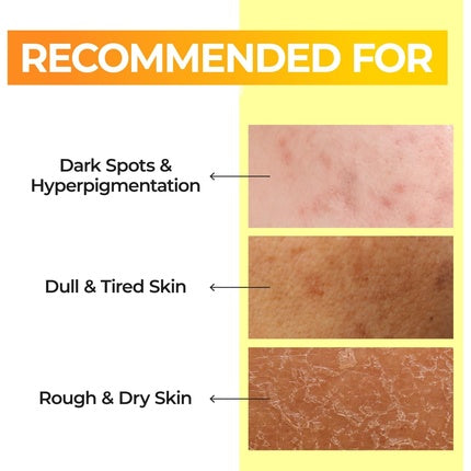 Numbuzin No.5 Toner Vitamin Boosting Essential Toner First Step Skin Care