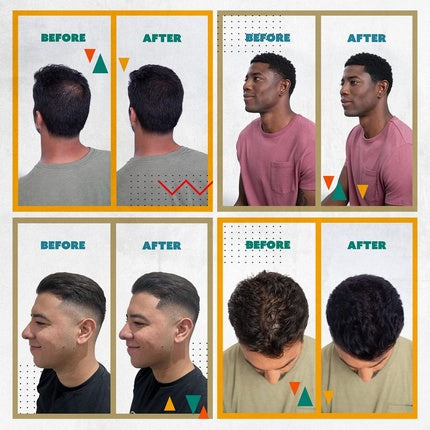 Toppik Hair Building Fibers Powder Dark Brown 3g Bottle - Instant Thinning Concealer for Men and Women