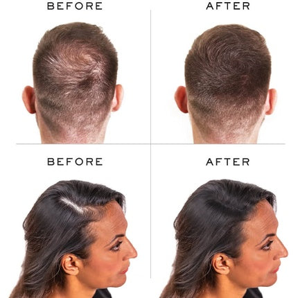 Nanogen Hair Thickening Fibres Light Brown 15g