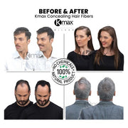 Kmax Concealing Hair Fibers Keratin Hair Powder for Hair Thickening Effect Hair Fibers for Covering Hair Loss Regular Size 15g Dark Brown