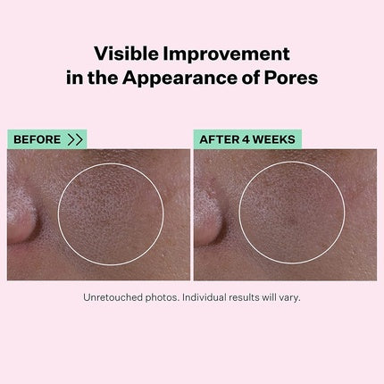 StriVectin Super Shrink Pore Minimizing Serum for Clogged Pores and Blackheads Tightening and Brightening Skin Texture