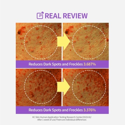 Sungboon Editor Meoru Podo Vita C Turn-Over Pad 60 Sheets with Niacinamide and Vitamin