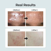 Numbuzin No.1 Pure Full Calming Herb Toner for Acne-Prone Skin with Centella Asiatica