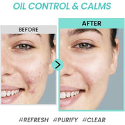 COXIR Tea Tree Pore & Sebum Emulsion 100ml for Oil Balance and Pore Minimization