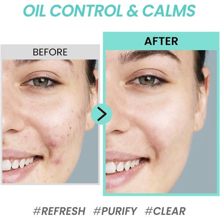 COXIR Tea Tree Pore & Sebum Emulsion 100ml for Oil Balance and Pore Minimization