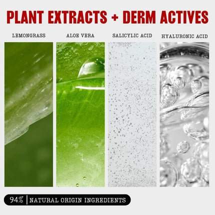 Thayers Blemish Clearing Salicylic Acid Toner Acne Treatment