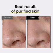 Coxir Black Rice Txa Pore Purifying Mask with Tranexamic Acid 3-in-1 Detox Serum