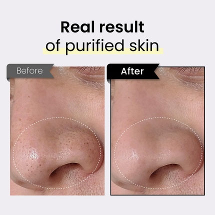 Coxir Black Rice Txa Pore Purifying Mask with Tranexamic Acid 3-in-1 Detox Serum