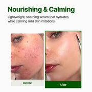 Nacific Cica PDRN Calming Serum 50ml Centella Asiatica Soothing