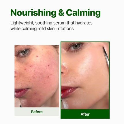 Nacific Cica PDRN Calming Serum 50ml Centella Asiatica Soothing