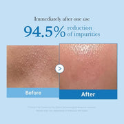 Medicube Zero Pore Blackhead Cleansing Oil Makeup Remover for All Skin Types