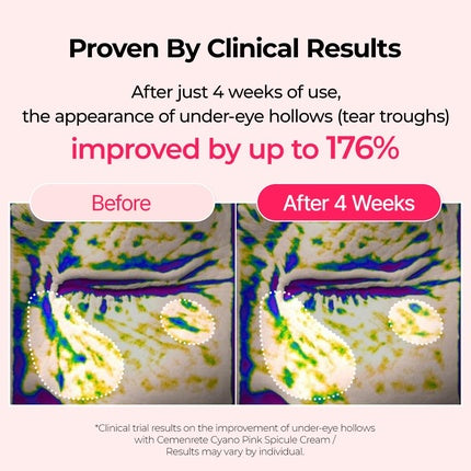 Cemenrete Cyano Pink Spicule Serum with Calcium and Vitamin B12 for Under Eyes