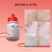 Dr.Ceuracle Azelaic10 & Madecassoside Ampoule