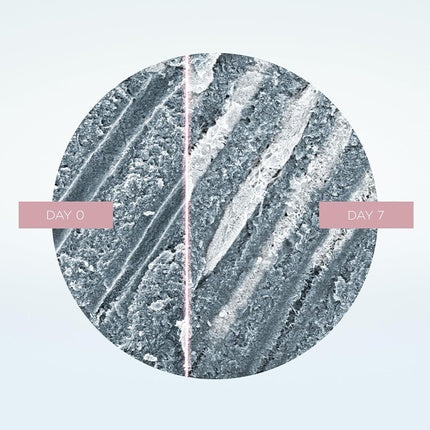 Regenerate Hypersensitivity Toothpaste Clinically Proven to Treat Sensitivity