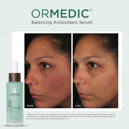 Image Skincare Ormedic Balancing Antioxidant Serum Hydrates and Soothes Skin
